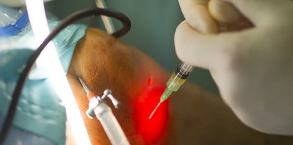 Foto New developments in platelet-rich plasma (PRP): new advances in the integration of extraplatelet molecules to improve its therapeutic efficacy.
